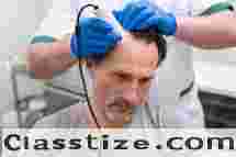Hair loss treatment in Bilaspur | Saluja Skin Clinic