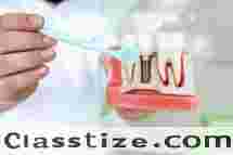 Best Dental Implant Clinic in Kolkata