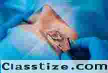 Clear Vision Starts Here – Eye Care Treatment in Bardhaman  