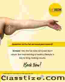 Liposuction Treatment In Tirupati