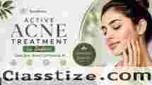 Active Acne Treatment in Indore – Aestheva