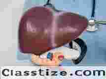 Trusted Chronic Liver Specialist in Ludhiana – Dr Nitin Bhel  