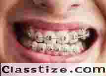 Affordable Dental Braces Treatment in Chetla by Experts  