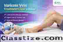 Varicose Vein Treatment Clinic in Indore – Sahaj Hospital