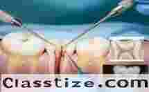 Best Root Canal Treatment in Chetla for Pain Relief