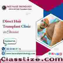 Best Direct Hair Implantation Services in Madurai
