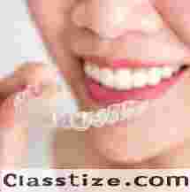Best Dental Braces in Newtown Kolkata – Expert Orthodontics