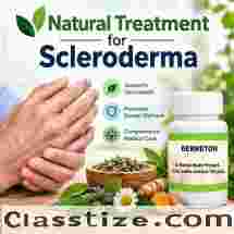 Natural Support for Scleroderma Skin Symptoms