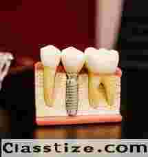Best Dental Clinic in Kolkata – Advanced Oral Care
