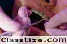 Affordable Dental Braces in Newtown Kolkata