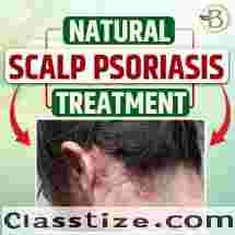 Achieving a Permanent Solution for Psoriasis Naturally: Effective Treatments for Facial and Scalp Psoriasis